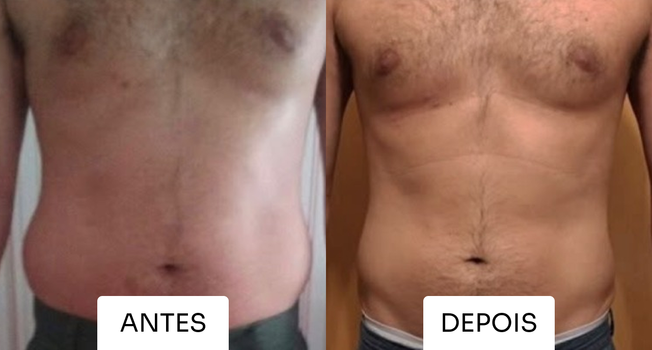 Resultado Mitras Estética 2
