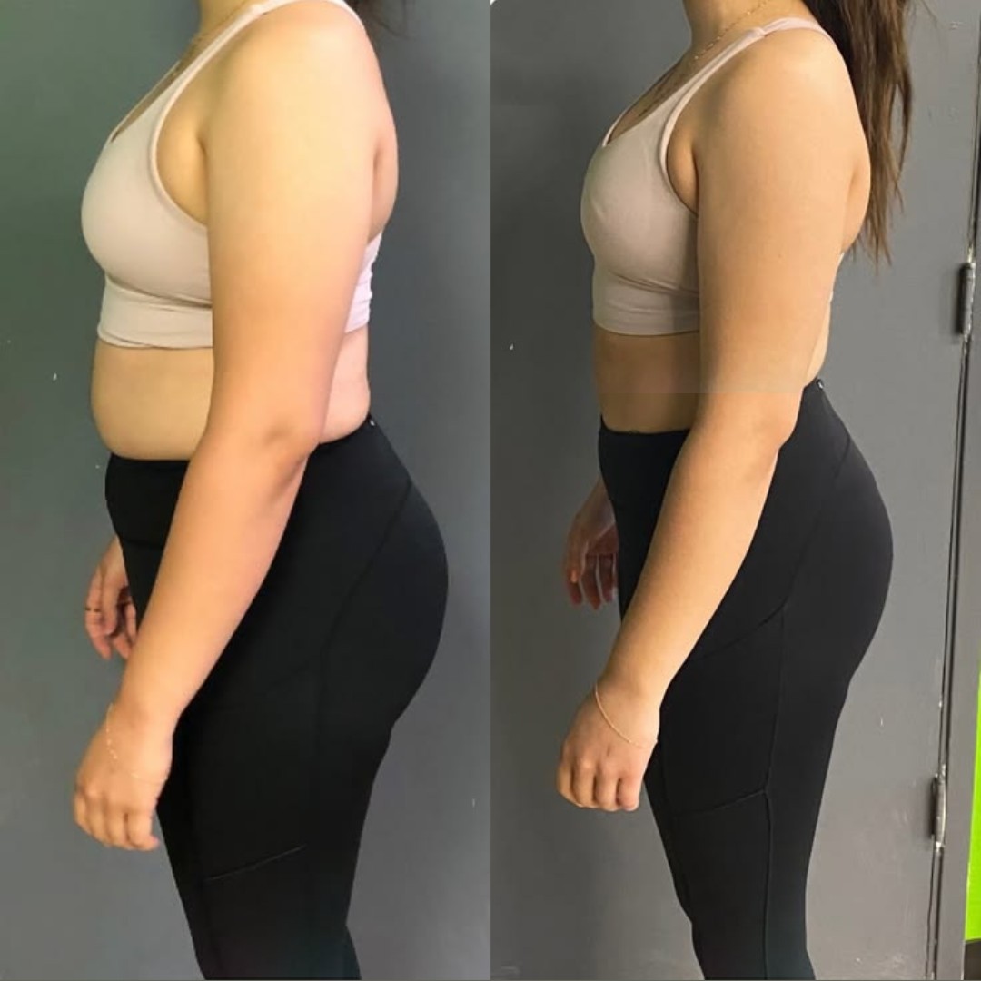 Resultado SecaFit